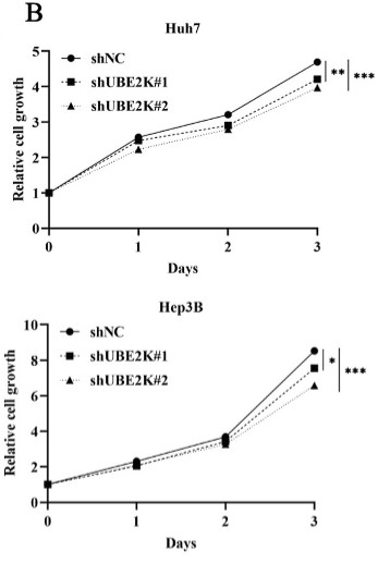 CCK-8 assay showed that UBE2K knockdown inhibited the cell viability.jpg